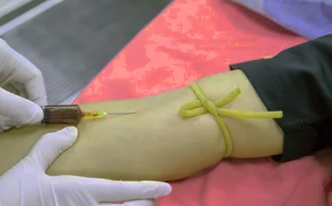 关于患者感谢信汇编9篇